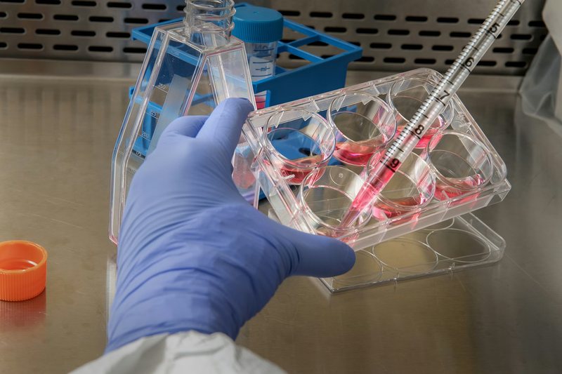 Microbial Screening, Selection and Strain Development